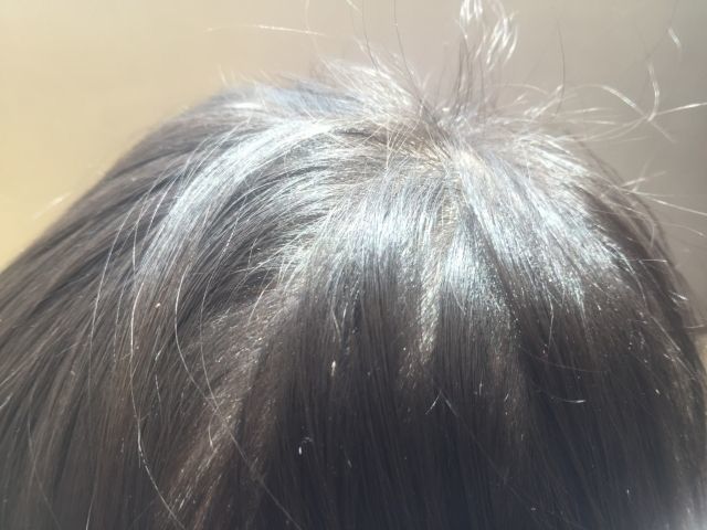 ハゲる髪質 柔らかい髪質 猫っ毛 細い髪はハゲやすい 危ない髪質総まとめ ハゲ治療ゼミ 薄毛 Aga治療 育毛剤の徹底研究サイト