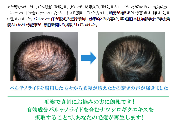 フィーバーフュー 大阪大学の研究により髪の発毛育毛効果が確認された
