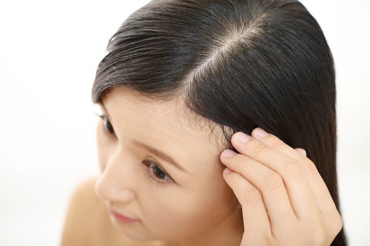 体験談あり ミノキシジルは女性にも効果ある 効果と副作用徹底まとめ ハゲ治療ゼミ 薄毛 Aga治療 育毛剤の徹底研究サイト