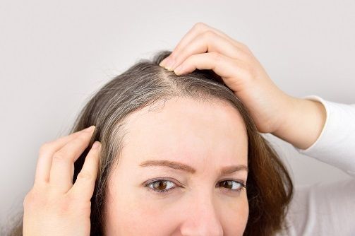 薄毛対策薄毛治療 抜毛症の原因 
